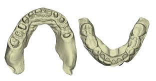 3D Printed Dental Models